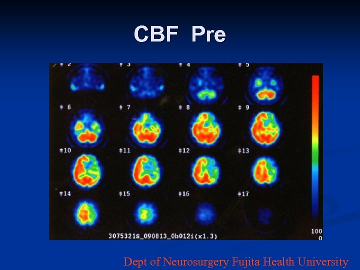 CBF Pre Dept of Neurosurgery Fujita Health University 