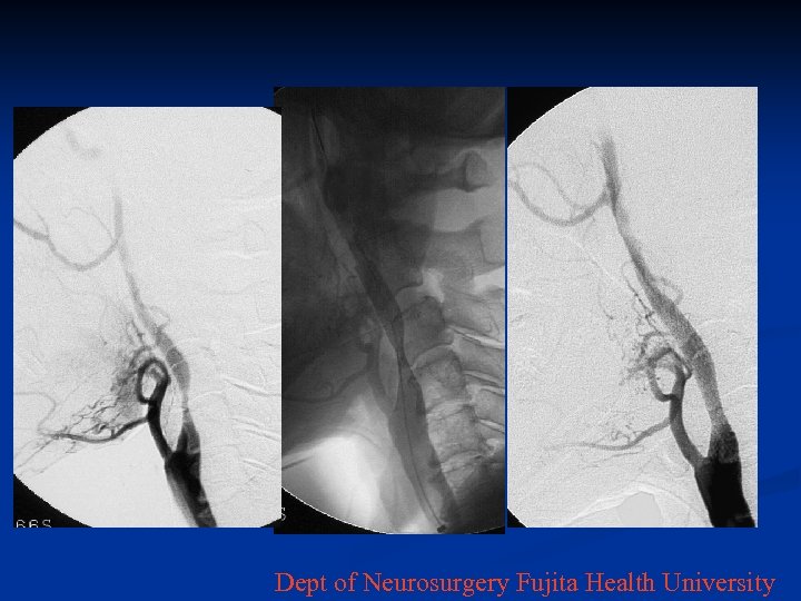 Dept of Neurosurgery Fujita Health University 