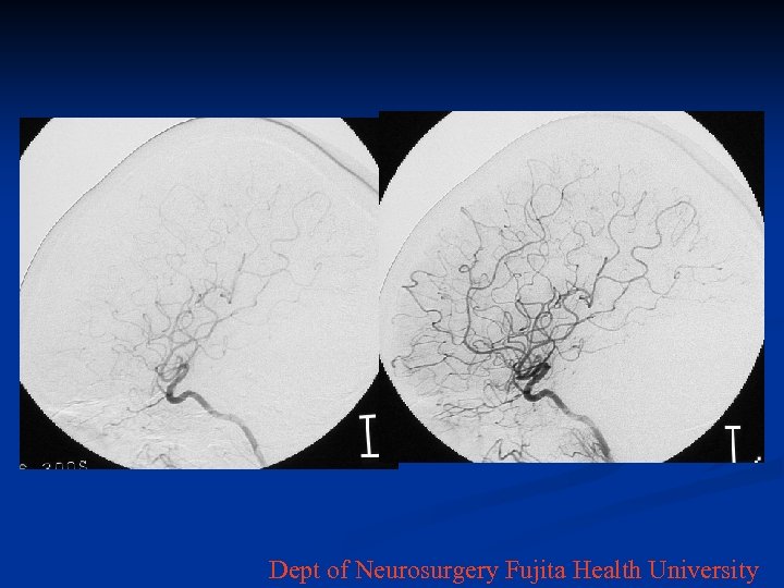 Dept of Neurosurgery Fujita Health University 