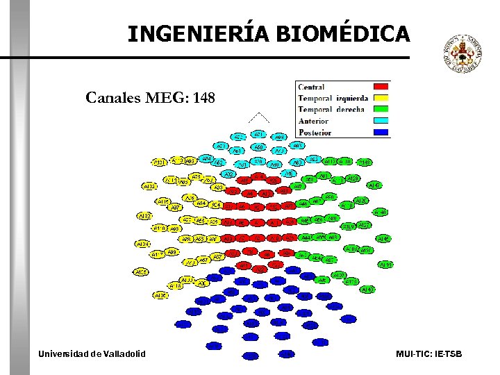 INGENIERÍA BIOMÉDICA Canales MEG: 148 Universidad de Valladolid MUI-TIC: IE-TSB 
