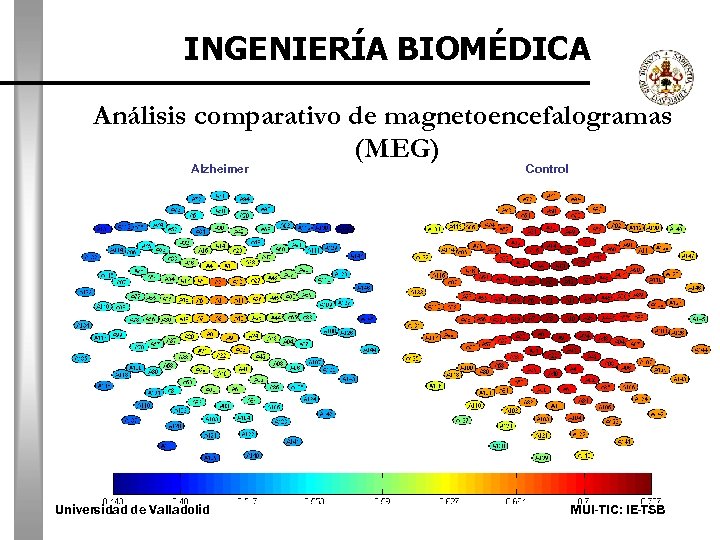 INGENIERÍA BIOMÉDICA Análisis comparativo de magnetoencefalogramas (MEG) Alzheimer Universidad de Valladolid Control MUI-TIC: IE-TSB