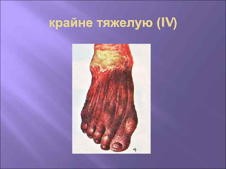 крайне тяжелую (IV) 