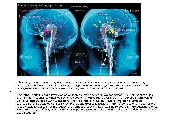  • • . Наконец, это механизм парадоксального сна, который запускается из четко очерченного
