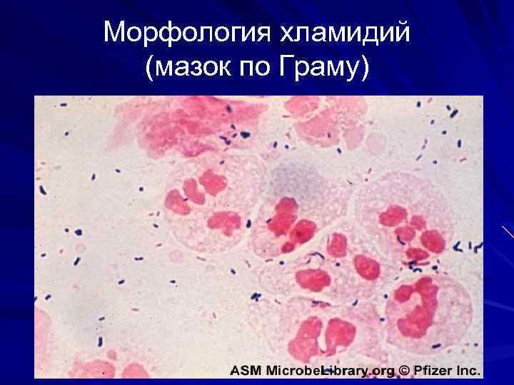 Морфология хламидий (мазок по Граму) 9 