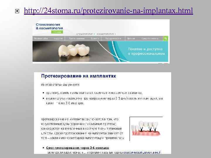  http: //24 stoma. ru/protezirovanie-na-implantax. html 