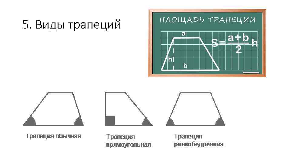 5. Виды трапеций 