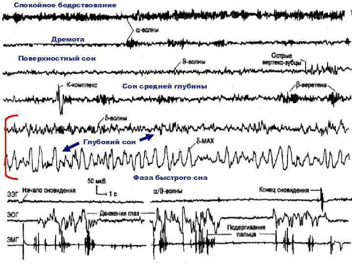 Бодрствование и сон схема
