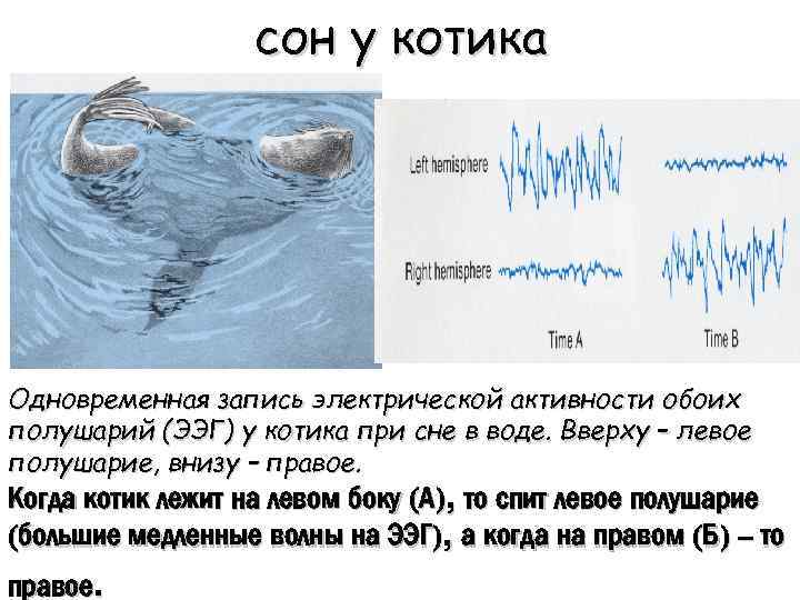 cон у котика Одновременная запись электрической активности обоих полушарий (ЭЭГ) у котика при сне
