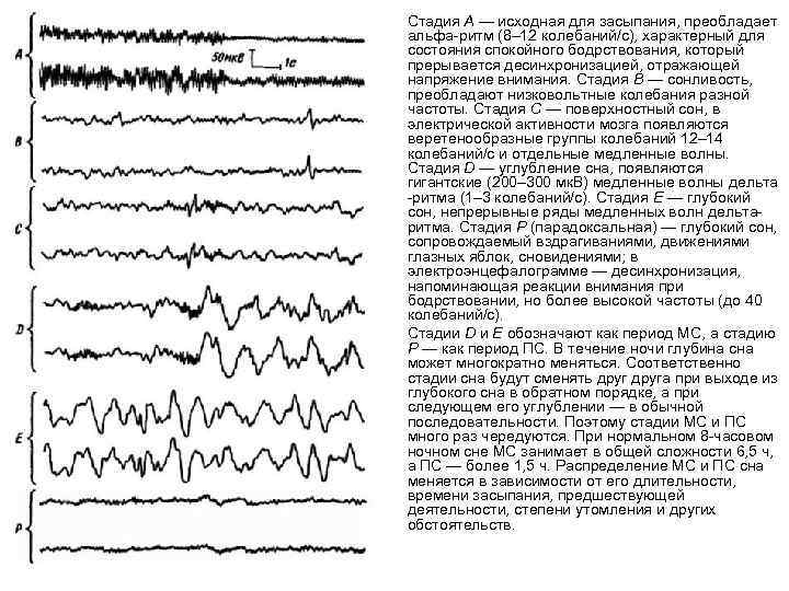 Схема стадий сна по данным ээг