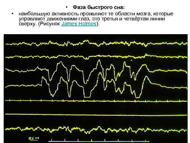  • Фаза быстрого сна: • наибольшую активность проявляют те области мозга, которые управляют