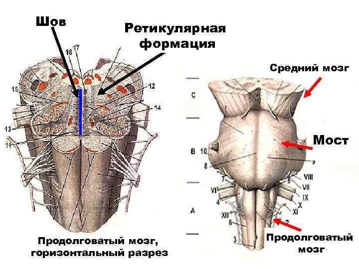 Шов Ретикулярная формация Средний мозг Мост Продолговатый мозг, горизонтальный разрез Продолговатый мозг 