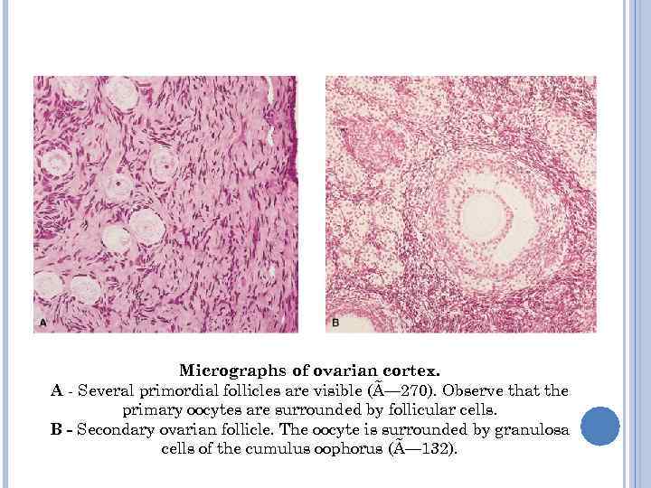 Micrographs of ovarian cortex. A - Several primordial follicles are visible (Ã— 270). Observe