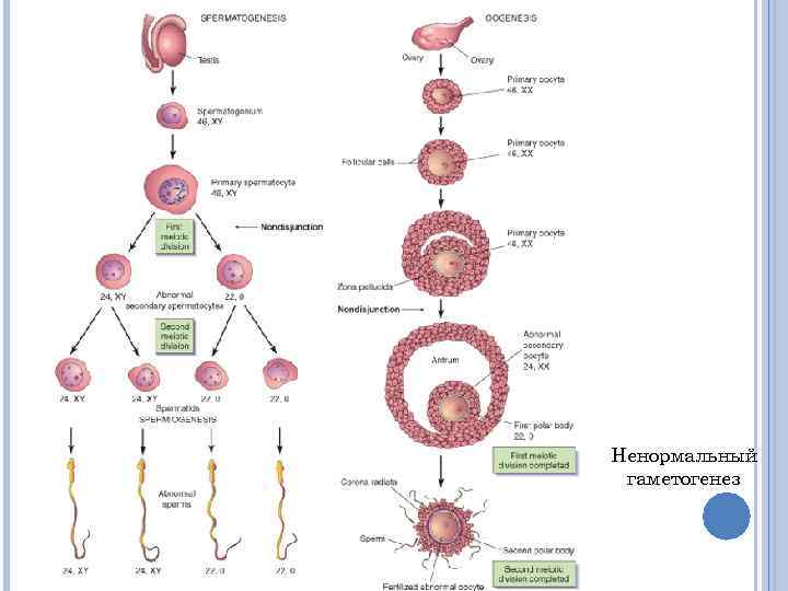 Ненормальный гаметогенез 