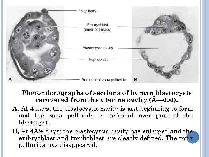 Photomicrographs of sections of human blastocysts recovered from the uterine cavity (Ã— 600). A,