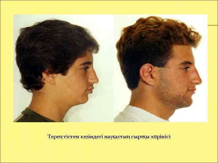 Терең тістем кезіндегі науқастың сыртқы көрінісі 