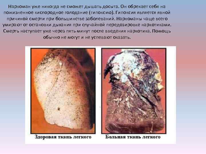 Наркоман уже никогда не сможет дышать досыта. Он обрекает себя на пожизненное кислородное голодание