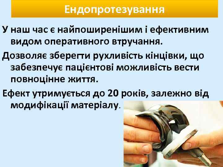 Ендопротезування У наш час є найпоширенішим і ефективним видом оперативного втручання. Дозволяє зберегти рухливість