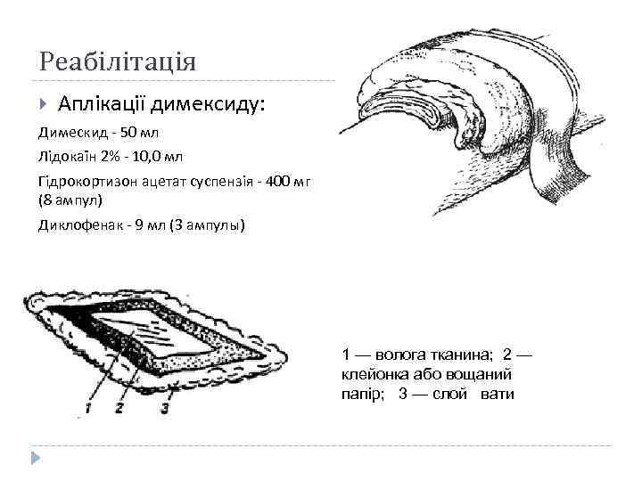Реабілітація Аплікації димексиду: Димескид - 50 мл Лідокаїн 2% - 10, 0 мл Гідрокортизон