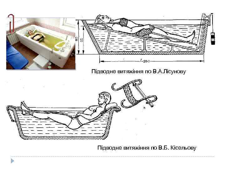 Підводне витяжіння по В. А. Лісунову Підводне витяжіння по В. Б. Кісельову 