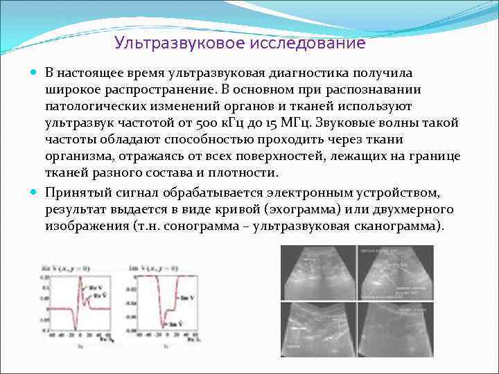 Ультразвуковое исследование В настоящее время ультразвуковая диагностика получила широкое распространение. В основном при распознавании