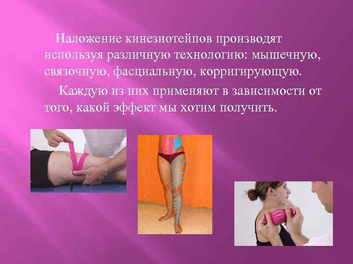  Наложение кинезиотейпов производят используя различную технологию: мышечную, связочную, фасциальную, корригирующую. Каждую из них