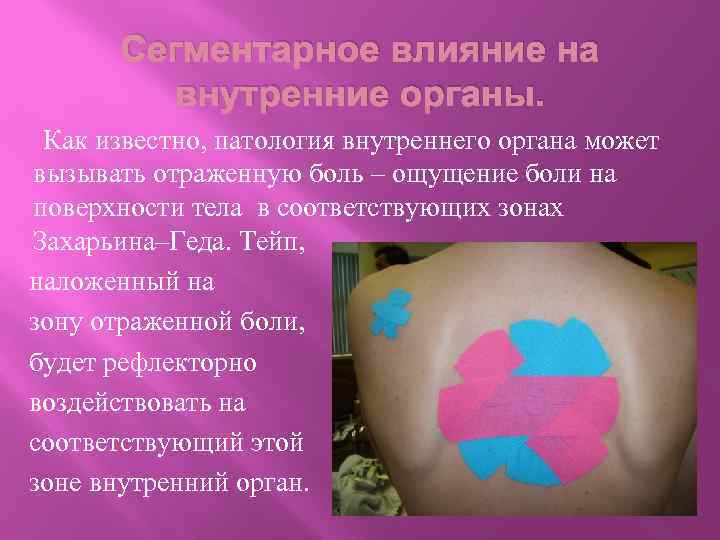Сегментарное влияние на внутренние органы. Как известно, патология внутреннего органа может вызывать отраженную боль