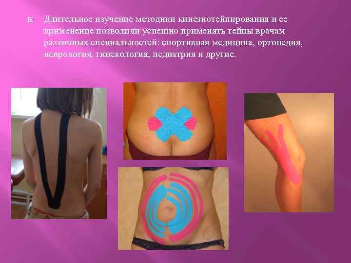  Длительное изучение методики кинезиотейпирования и ее применение позволили успешно применять тейпы врачам различных