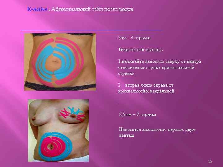 K-Active : Абдоминальный тейп после родов -------------------------------------------5 см – 3 отрезка. Техника для мышцы.
