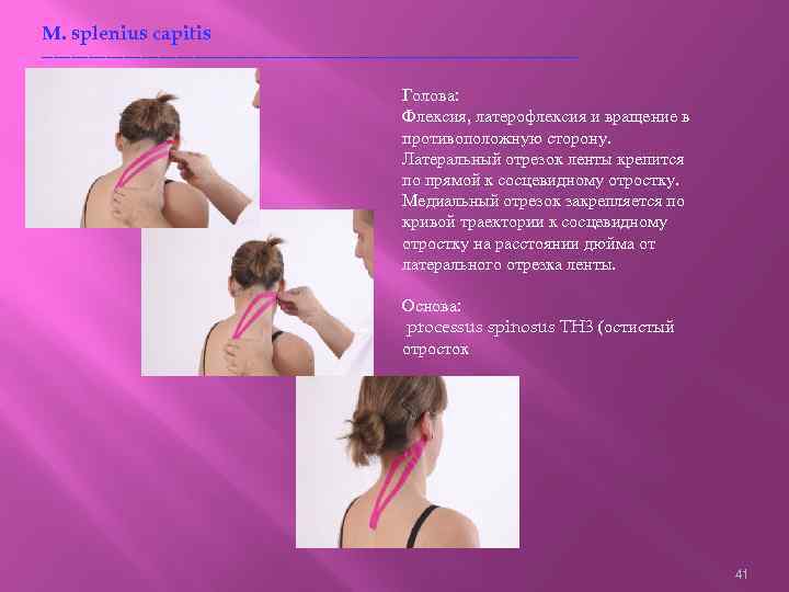M. splenius capitis ----------------------------------------------Голова: Флексия, латерофлексия и вращение в противоположную сторону. Латеральный отрезок ленты