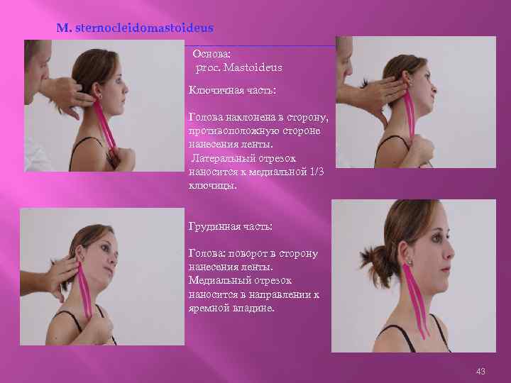 M. sternocleidomastoideus ------------------------------------------Основа: proc. Mastoideus Ключичная часть: Голова наклонена в сторону, противоположную стороне нанесения