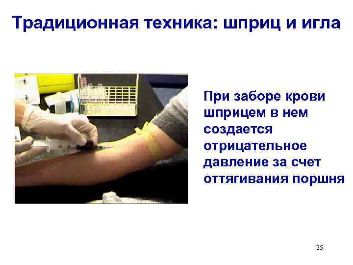 Традиционная техника: шприц и игла При заборе крови шприцем в нем создается отрицательное давление