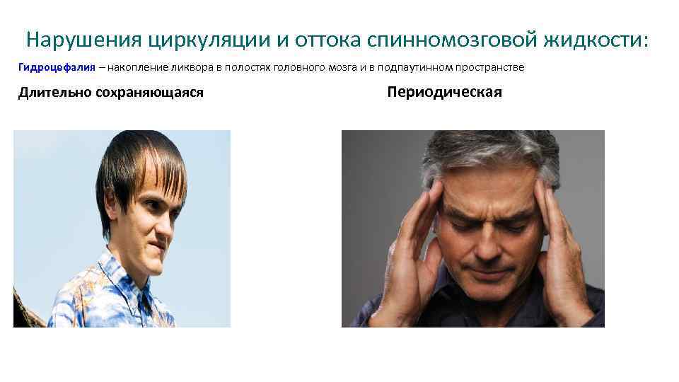 Нарушения циркуляции и оттока спинномозговой жидкости: Гидроцефалия – накопление ликвора в полостях головного мозга