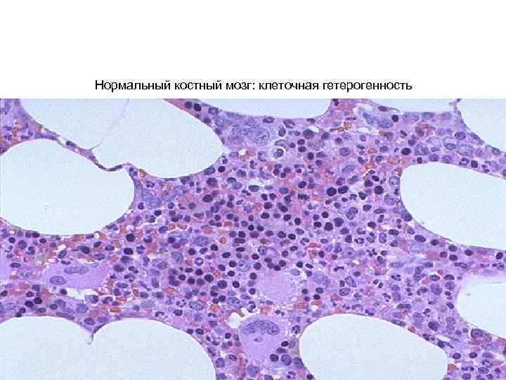 Нормальный костный мозг: клеточная гетерогенность 
