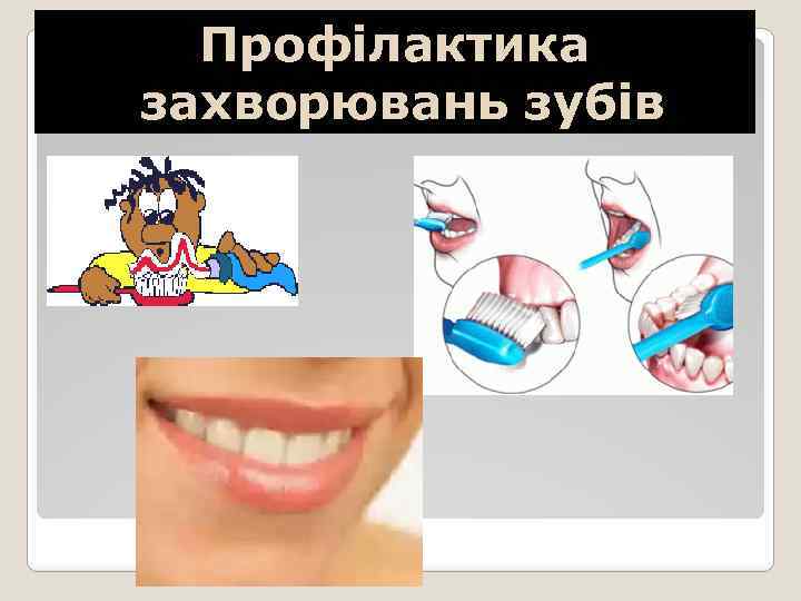Профілактика захворювань зубів 