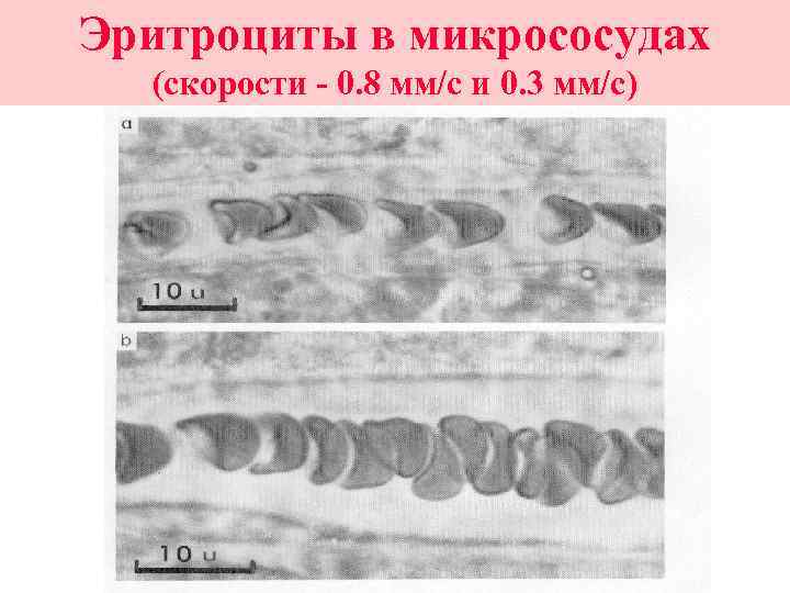 Эритроциты в микрососудах (скорости - 0. 8 мм/с и 0. 3 мм/с) 