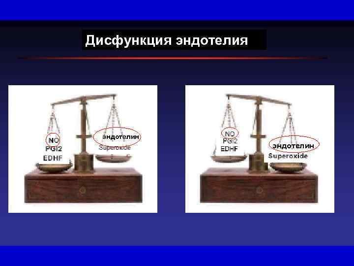 Дисфункция эндотелин 