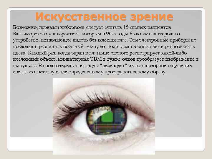 Искусственное зрение Возможно, первыми киборгами следует считать 15 слепых пациентов Балтиморского университета, которым в