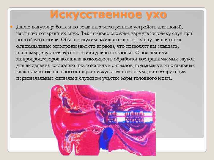 Искусственное ухо Давно ведутся работы и по созданию электронных устройств для людей, частично потерявших