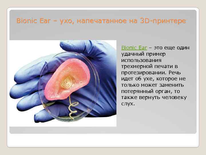 Bionic Ear – ухо, напечатанное на 3 D-принтере Bionic Ear – это еще один