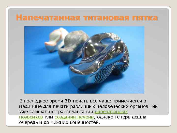 Напечатанная титановая пятка В последнее время 3 D-печать все чаще применяется в медицине для