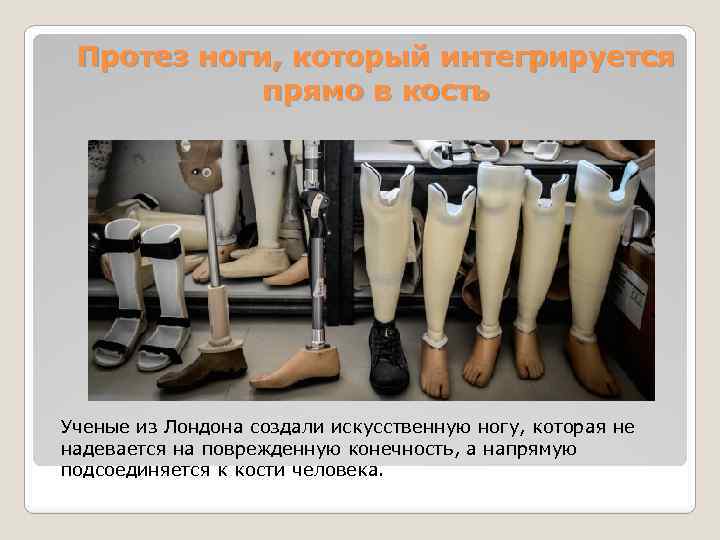 Протез ноги, который интегрируется прямо в кость Ученые из Лондона создали искусственную ногу, которая