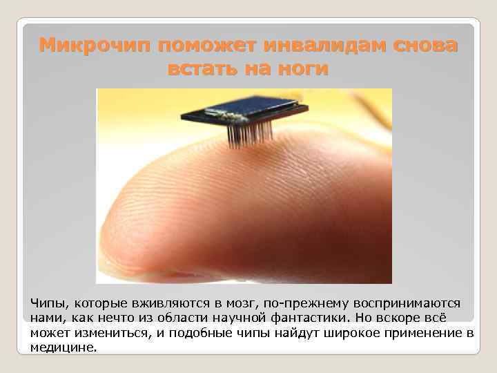 Микрочип поможет инвалидам снова встать на ноги Чипы, которые вживляются в мозг, по-прежнему воспринимаются
