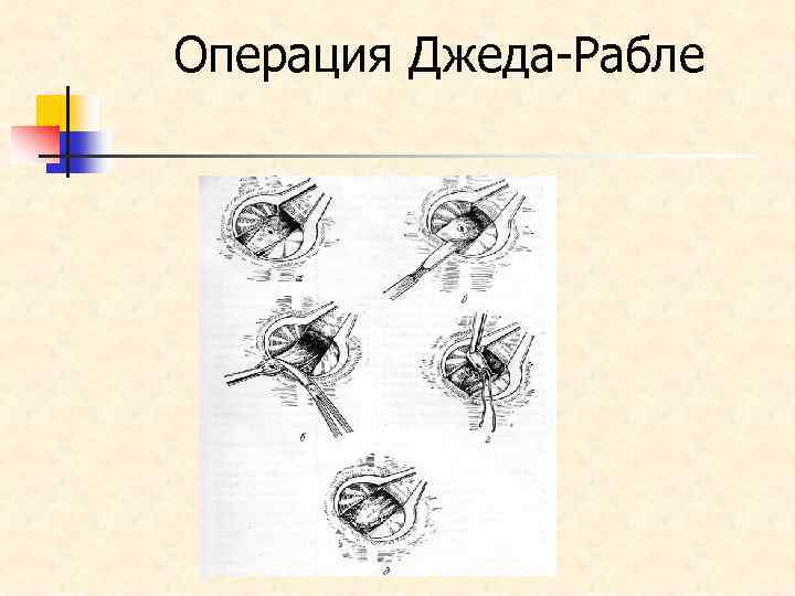 Операция Джеда-Рабле 