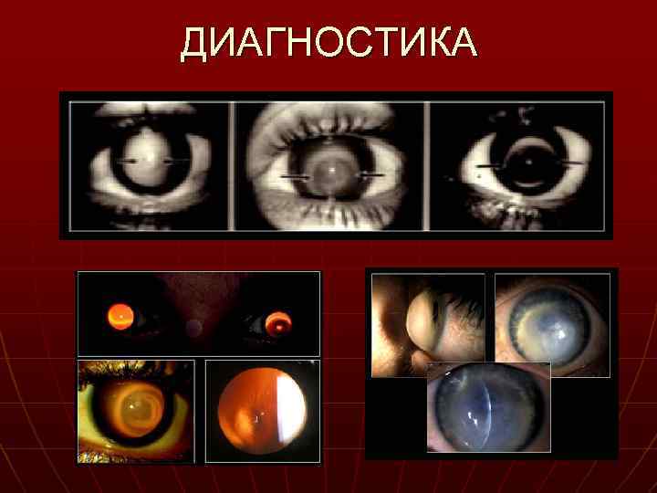 ДИАГНОСТИКА 