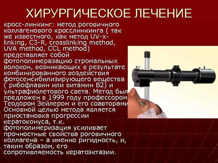 ХИРУРГИЧЕСКОЕ ЛЕЧЕНИЕ кросс-линкинг: метод роговичного коллагенового кросслинкинга ( так же известного, как метод UV-xlinking,