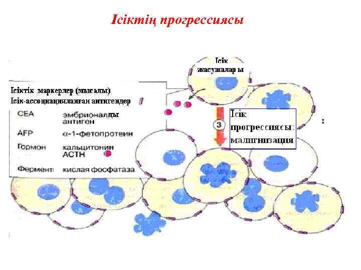 Ісіктің прогрессиясы 