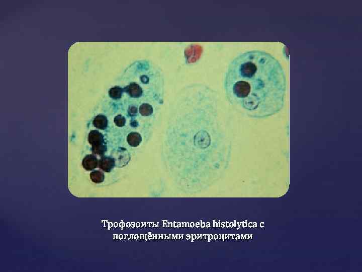 Трофозоиты Entamoeba histolytica с поглощёнными эритроцитами 