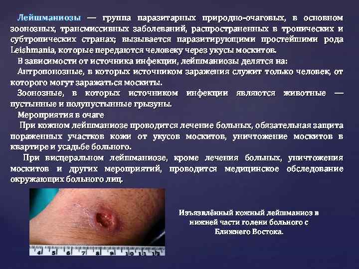 Лейшманиозы — группа паразитарных природно-очаговых, в основном зоонозных, трансмиссивных заболеваний, распространенных в тропических и