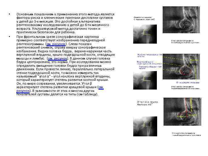  • • Основным показанием к применению этого метода является факторы риска и клинические