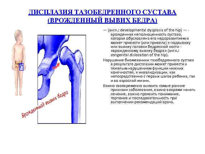 Вывих тазобедренного сустава у взрослых симптомы